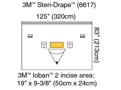 Isolation Drape with Ioban 2 Incise Film and Pouch Illus 6617