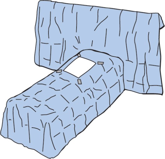 Laparoscopy Drape - Supine Position, Illustration 1031