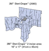 Abdomino-Perineal Drape with Incise film 2065