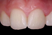 Case 5