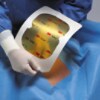 3M™ Ioban™ 2 Antimicrobial Incise Drape