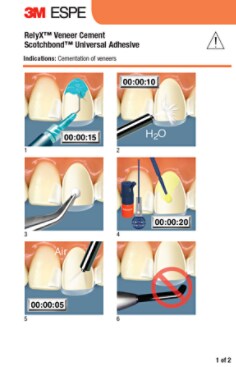 RelyX Veneer - Cementation of Veneers