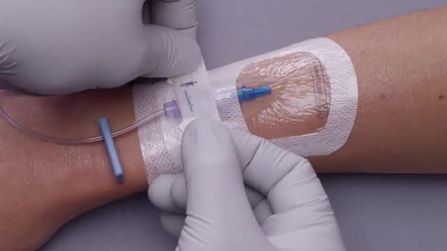 Tegaderm antimicrobial dressing being applied to an arm with an IV