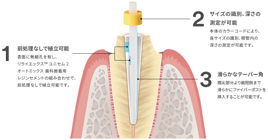 リライエックス™ ユニセム ２ オートミックス 歯科接着用レジンセメントとの組み合わせ
