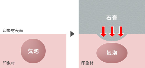 印象材内部に気泡が混入している場合
