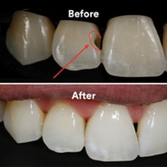 Universal_Before_After_04.jpg