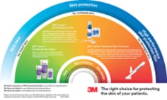 3M™ Cavilon™ MASD Decision Tool