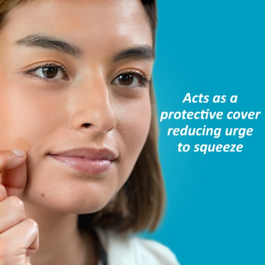 Nexcare™ Acne Blemish Cover - Reduces urge to squeeze