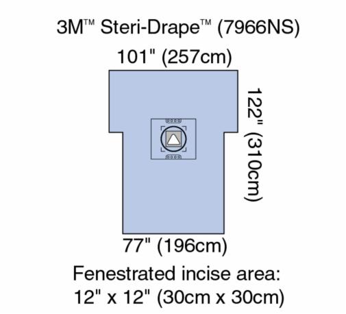 Steri-Drape Cesarean Section Sht w Aperture Pouch Illus 7966NS