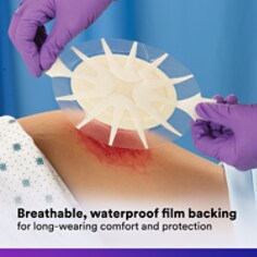 msd-tegaderm-high-performance-foam-adhesive-dressing-b00035953-90613-pdpimage4-glbl-en.tif
