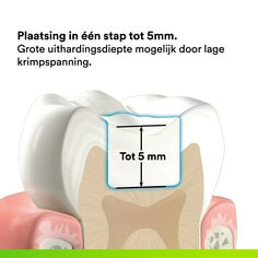 2- Filtek One- Plaatsing in één stap tot 5mm