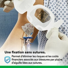 fixation sans suture - aide à éliminer les risques et les coûts liés aux blessures par piqûre d'aiguille liées aux sutures