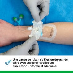 La grande bande de fixation avec encoche favorise une application cohérente et correcte