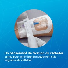 Fixation du cathéter conçue pour minimiser les mouvements et le délogement du cathéter