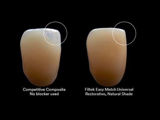 3M™ Filtek™ Easy Match Universal Restorative Clinical Comparison Aplus 3b, 666x333, RGB PNG