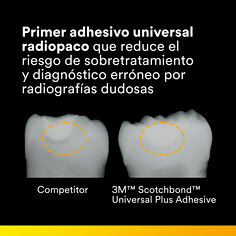 2 - El adhesivo 3M™ Scotchbond™ Universal Plus