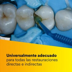 1 - El adhesivo 3M™ Scotchbond™ Universal Plus