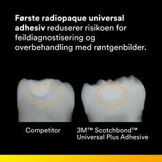 Første radiopaque universal adhesiv reduserer risikoen for feildiagnostisering og overbehandling med røntgenbilder