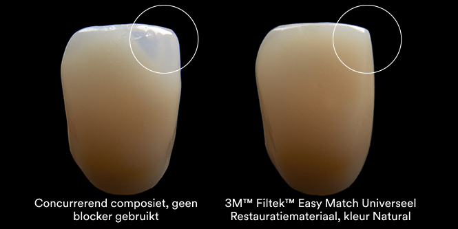 3M™ Filtek™ Easy Match Universal Restorative Clinical Comparison Aplus 3b, 666x333, RGB PNG