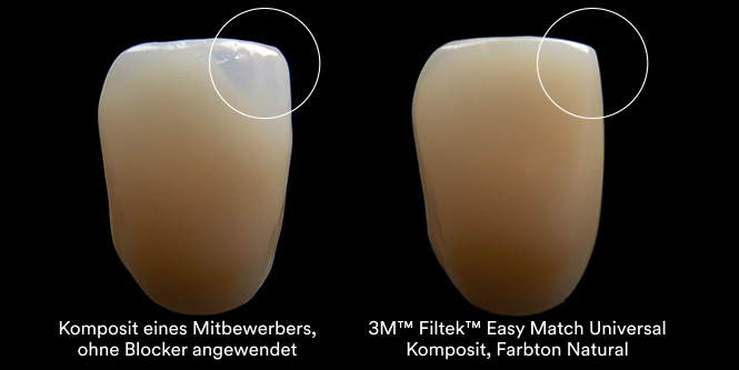 3M™ Filtek™ Easy Match Universal Restorative Clinical Comparison Aplus 3b, 666x333, RGB PNG