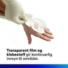 Transparent film og lim gir kontinuerlig observasjon av stedet