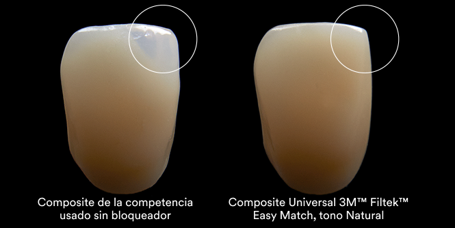 3M™ Filtek™ Easy Match Universal Restorative Clinical Comparison Aplus 3b, 666x333, RGB PNG