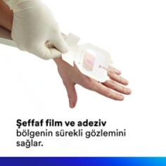 Şeffaf film ve yapışkan sürekli saha gözlemi sağlar