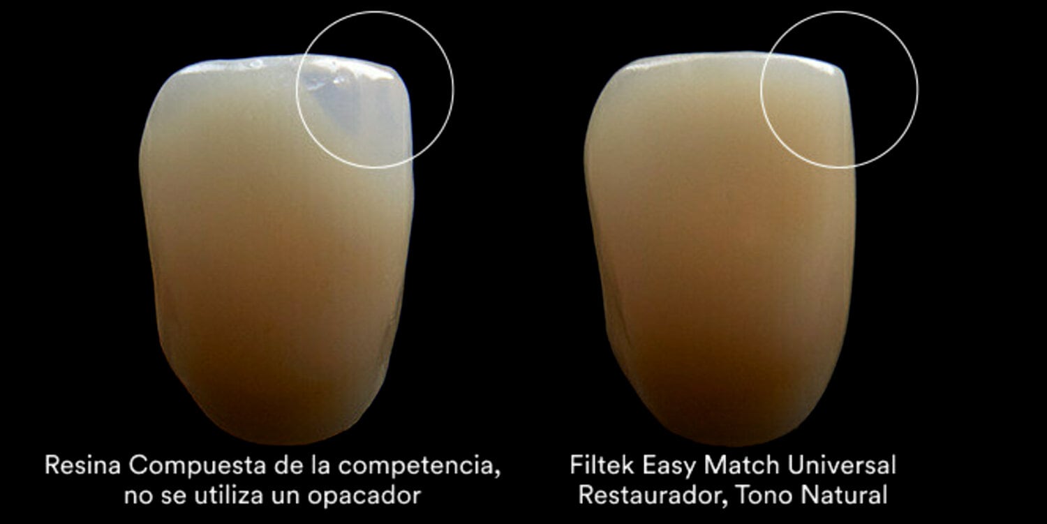 3M™ Filtek™ Easy Match Universal Restorative Clinical Comparison Aplus 3b, 666x333, RGB PNG