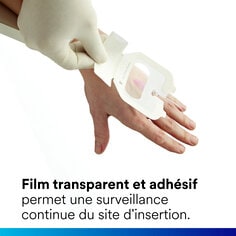 Le film et l'adhésif transparents permettent une observation continue du site