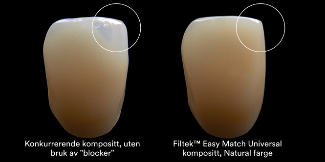 3M™ Filtek™ Easy Match Universal Restorative Clinical Comparison Aplus 3b, 666x333, RGB PNG