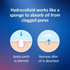 How hydrocolloid works to remove pus from blemish. Two graphics show how the hyrdocolloid works to remove oil and pus from blemish