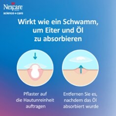 nexcare-acne-patch-enhanced-b3-de.jpg